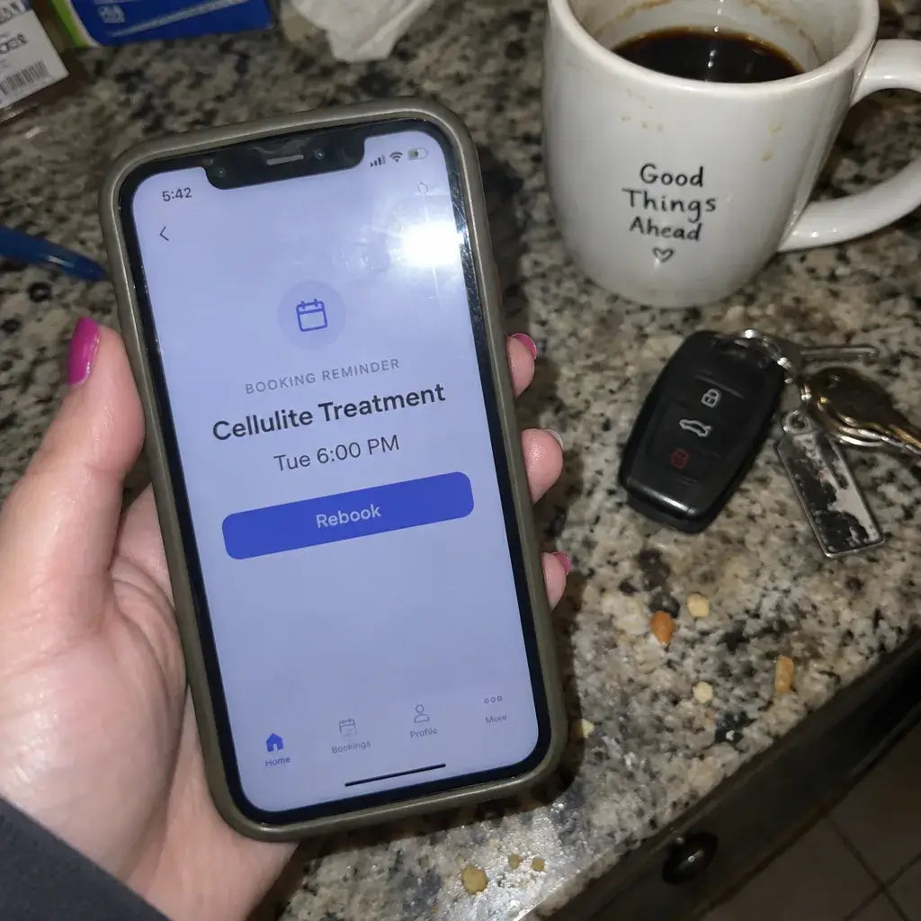 A booking reminder for a cellulite treatment on a kitchen table